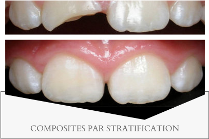 COMPOSITES PAR STRATIFICATION