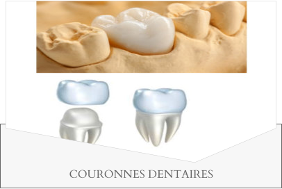 COURONNES DENTAIRES