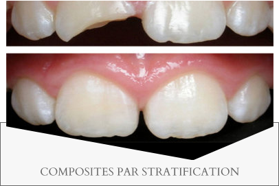 COMPOSITES PAR STRATIFICATION
