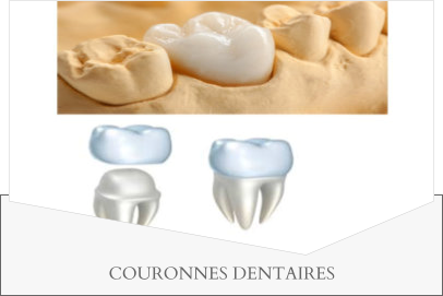 COURONNES DENTAIRES