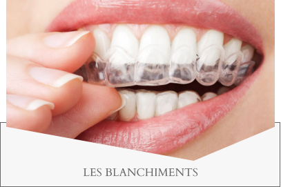 LES BLANCHIMENTS