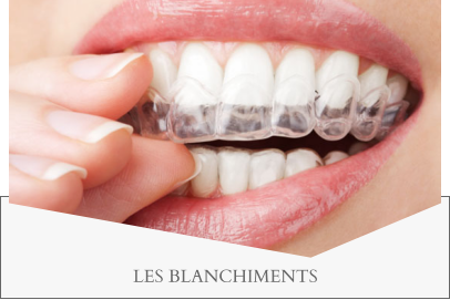 LES BLANCHIMENTS